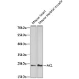 Western Blot - Anti-AK 1 Antibody (A13386) - Antibodies.com