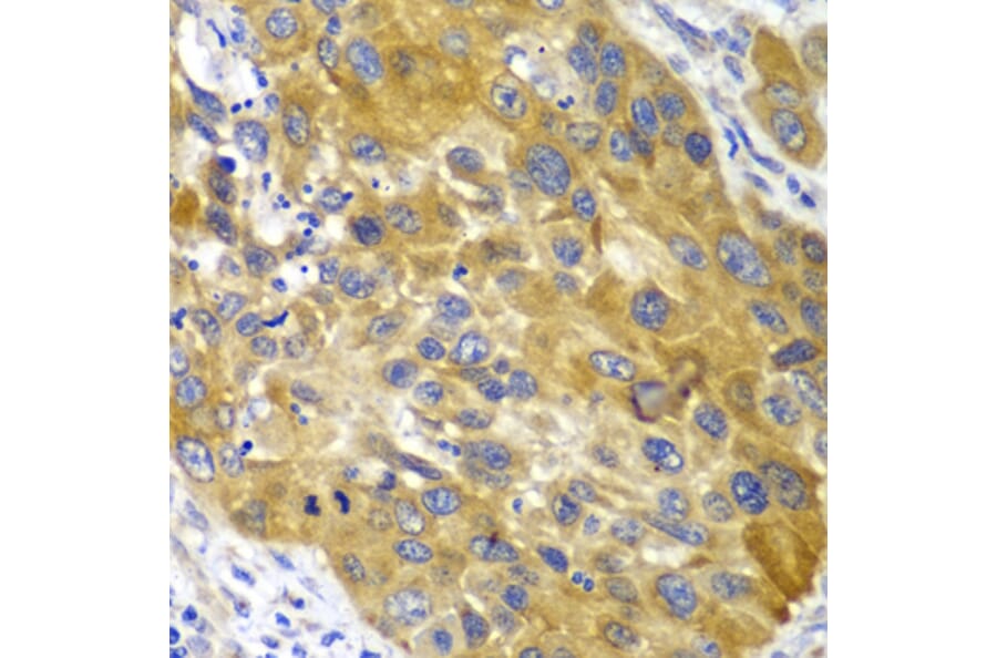 Immunohistochemistry - Anti-AK 1 Antibody (A13386) - Antibodies.com