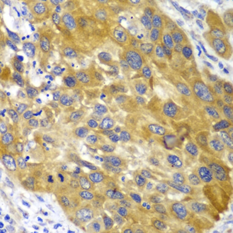Immunohistochemistry - Anti-AK 1 Antibody (A13386) - Antibodies.com