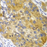 Immunohistochemistry - Anti-AK 1 Antibody (A13386) - Antibodies.com