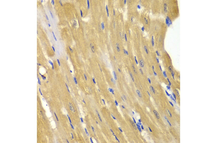 Immunohistochemistry - Anti-AK 1 Antibody (A13386) - Antibodies.com