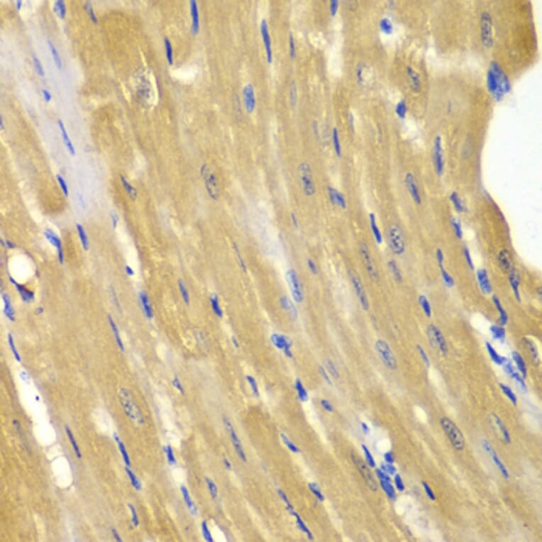 Immunohistochemistry - Anti-AK 1 Antibody (A13386) - Antibodies.com