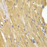 Immunohistochemistry - Anti-AK 1 Antibody (A13386) - Antibodies.com