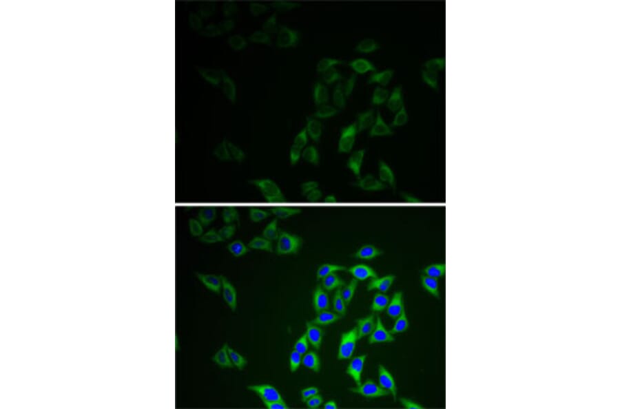 Immunofluorescence - Anti-AK 1 Antibody (A13386) - Antibodies.com