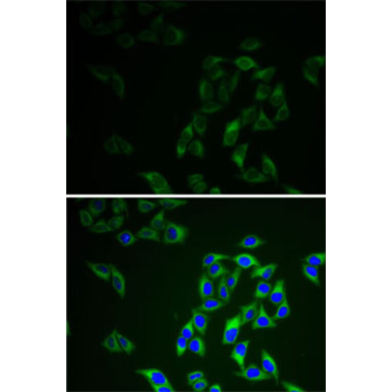 Immunofluorescence - Anti-AK 1 Antibody (A13386) - Antibodies.com