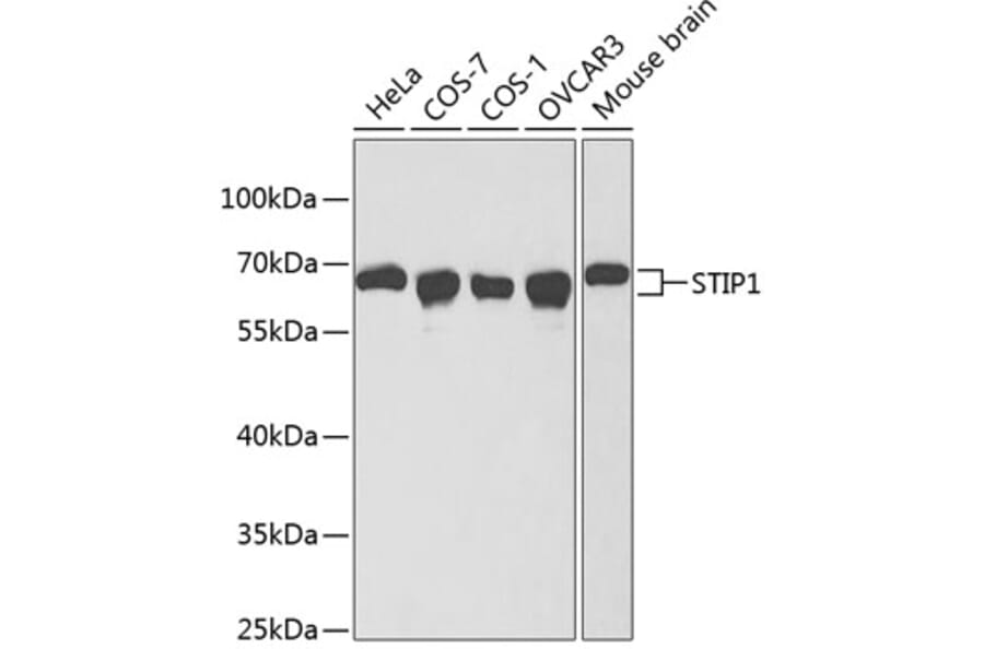 Western Blot - Anti-STIP1 Antibody (A1219) - Antibodies.com