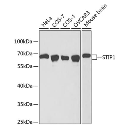 Western Blot - Anti-STIP1 Antibody (A13387) - Antibodies.com