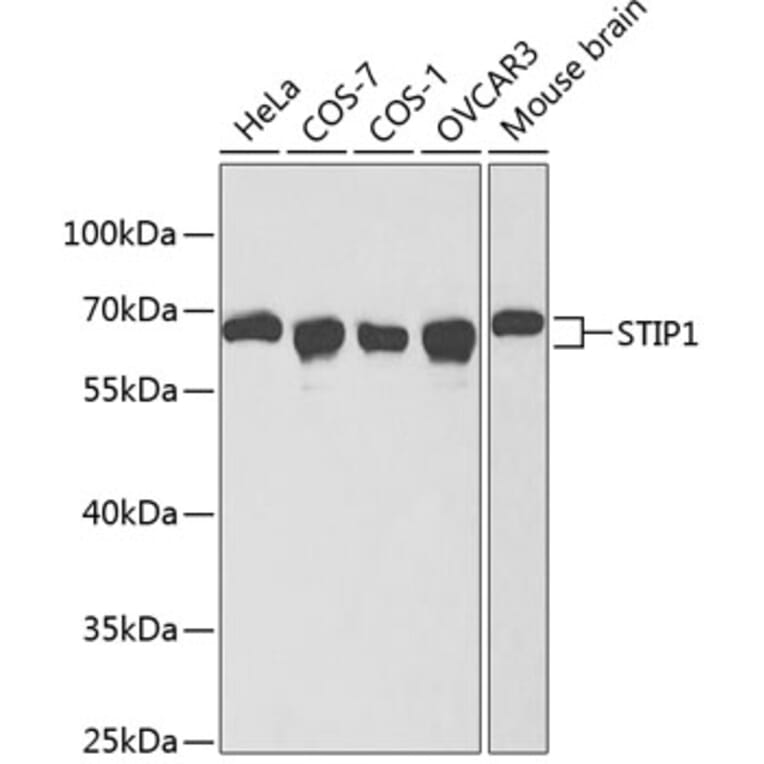 Western Blot - Anti-STIP1 Antibody (A1219) - Antibodies.com