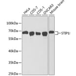 Western Blot - Anti-STIP1 Antibody (A1219) - Antibodies.com