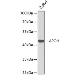Western Blot - Anti-Apo-H Antibody (A13388) - Antibodies.com