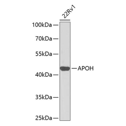 Western Blot - Anti-Apo-H Antibody (A13388) - Antibodies.com