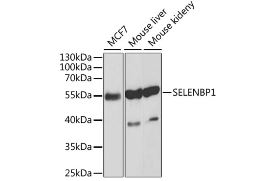 Western Blot - Anti-Selenium Binding Protein 1/SBP Antibody (A13390) - Antibodies.com