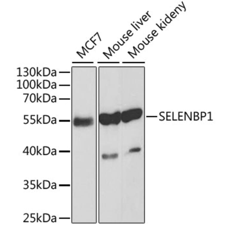 Western Blot - Anti-Selenium Binding Protein 1/SBP Antibody (A13390) - Antibodies.com