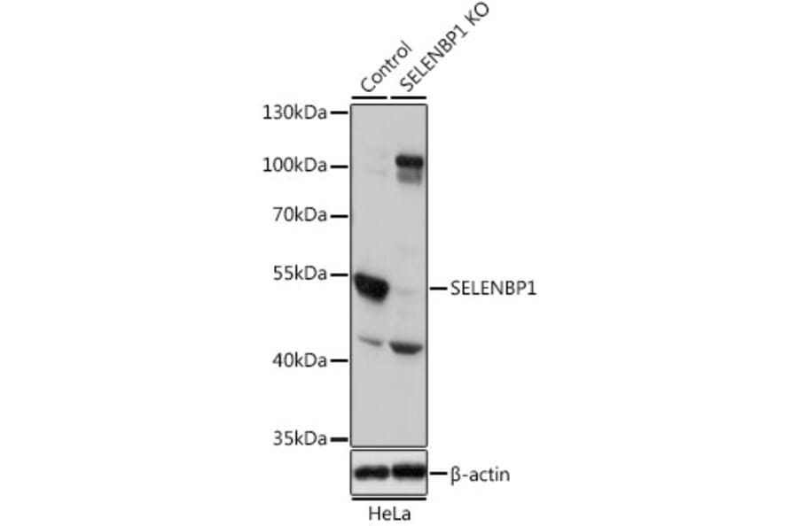 Western Blot - Anti-Selenium Binding Protein 1/SBP Antibody (A13390) - Antibodies.com