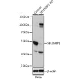 Western Blot - Anti-Selenium Binding Protein 1/SBP Antibody (A13390) - Antibodies.com