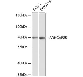 Western Blot - Anti-ARHGAP25 Antibody (A13391) - Antibodies.com