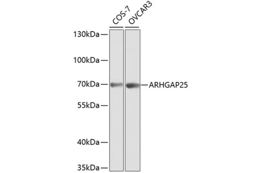 Western Blot - Anti-ARHGAP25 Antibody (A13391) - Antibodies.com