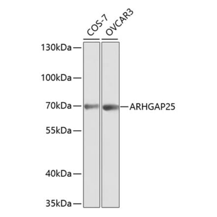 Western Blot - Anti-ARHGAP25 Antibody (A13391) - Antibodies.com