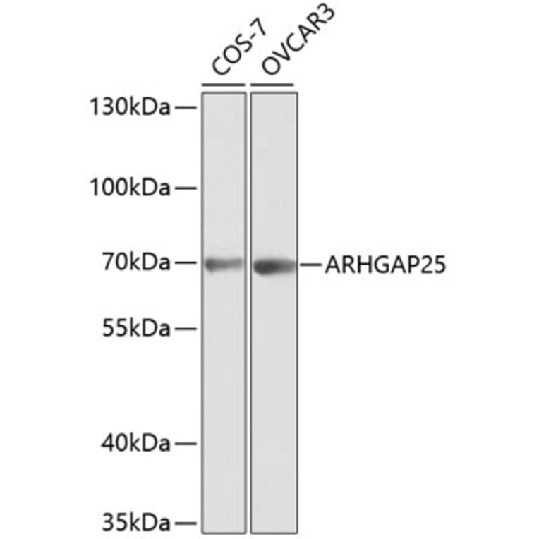 Western Blot - Anti-ARHGAP25 Antibody (A13391) - Antibodies.com