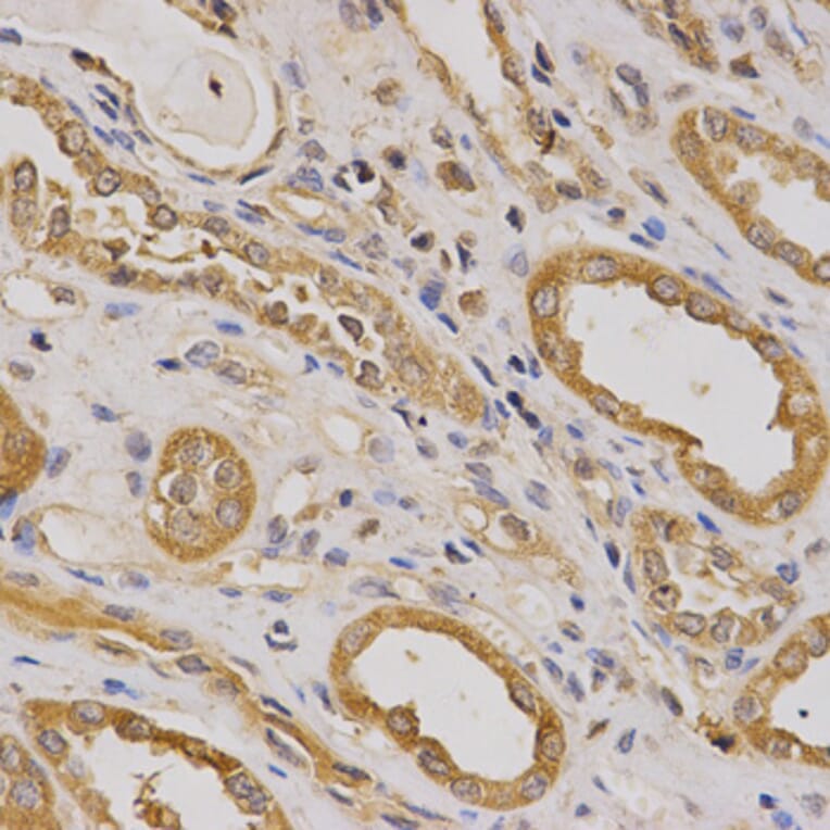 Immunohistochemistry - Anti-ARHGAP25 Antibody (A13391) - Antibodies.com