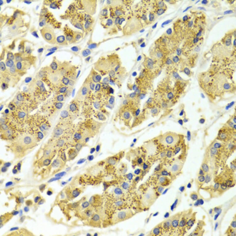 Immunohistochemistry - Anti-ARHGAP25 Antibody (A13391) - Antibodies.com