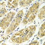 Immunohistochemistry - Anti-ARHGAP25 Antibody (A13391) - Antibodies.com