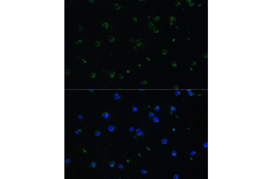 Immunofluorescence - Anti-ARHGAP25 Antibody (A13391) - Antibodies.com