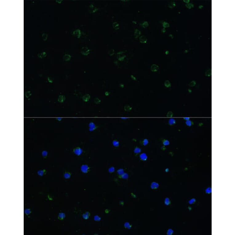 Immunofluorescence - Anti-ARHGAP25 Antibody (A13391) - Antibodies.com