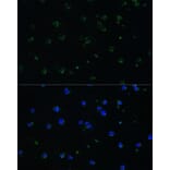 Immunofluorescence - Anti-ARHGAP25 Antibody (A13391) - Antibodies.com