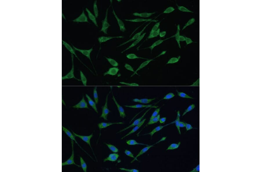 Immunofluorescence - Anti-ARHGAP25 Antibody (A13391) - Antibodies.com