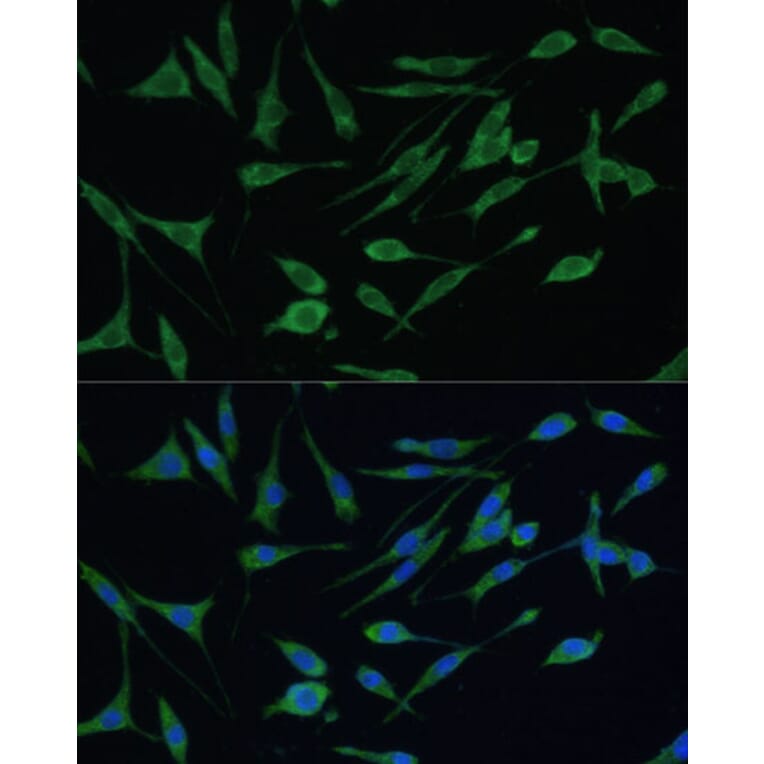 Immunofluorescence - Anti-ARHGAP25 Antibody (A13391) - Antibodies.com