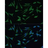 Immunofluorescence - Anti-ARHGAP25 Antibody (A13391) - Antibodies.com