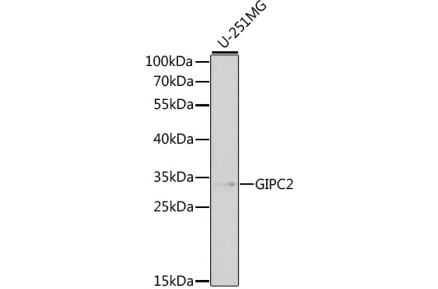 Western Blot - Anti-GIPC2 Antibody (A13392) - Antibodies.com