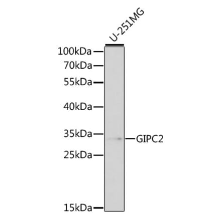 Western Blot - Anti-GIPC2 Antibody (A13392) - Antibodies.com