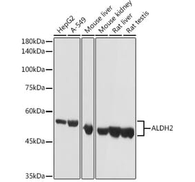 Western Blot - Anti-ALDH2 Antibody (A13393) - Antibodies.com