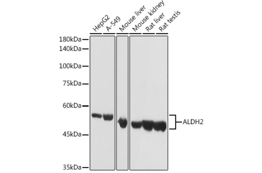 Western Blot - Anti-ALDH2 Antibody (A13393) - Antibodies.com