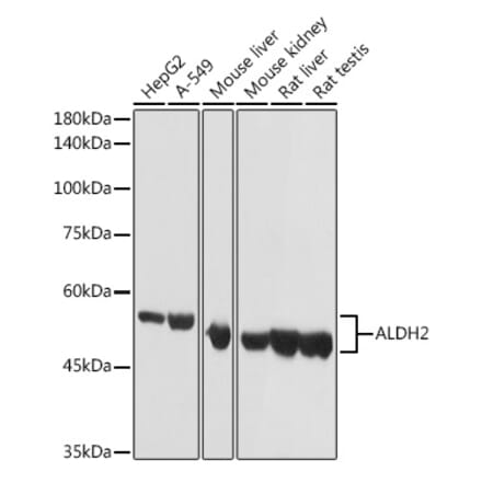 Western Blot - Anti-ALDH2 Antibody (A13393) - Antibodies.com