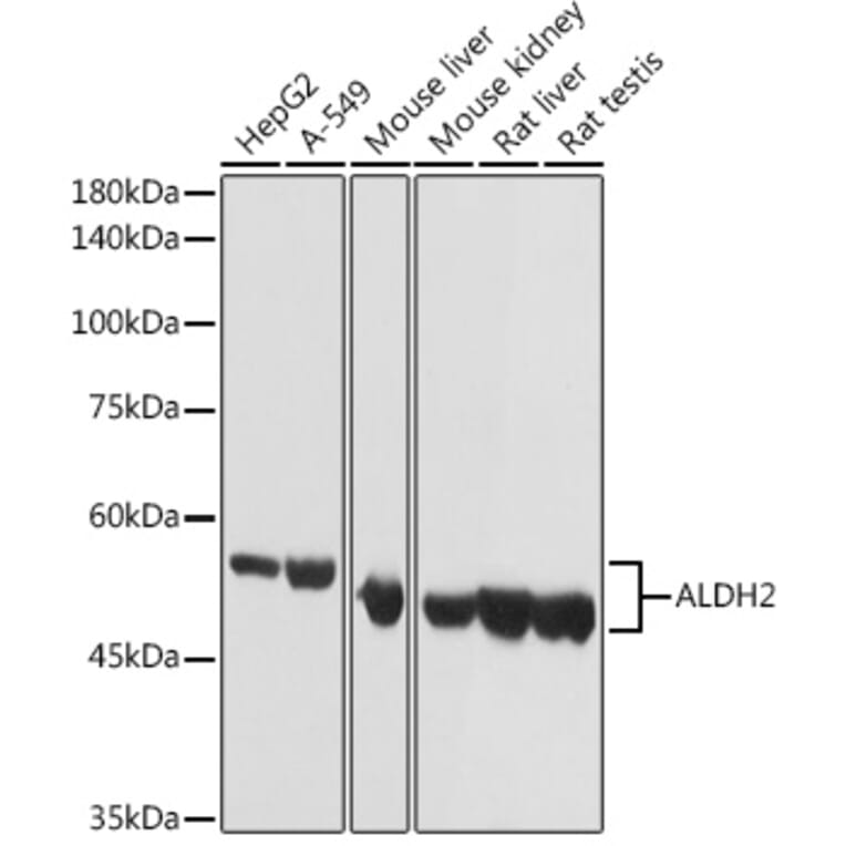 Western Blot - Anti-ALDH2 Antibody (A13393) - Antibodies.com