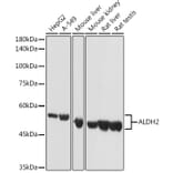 Western Blot - Anti-ALDH2 Antibody (A13393) - Antibodies.com