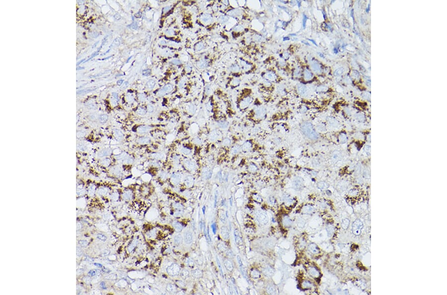 Immunohistochemistry - Anti-ALDH2 Antibody (A13393) - Antibodies.com