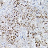 Immunohistochemistry - Anti-ALDH2 Antibody (A13393) - Antibodies.com