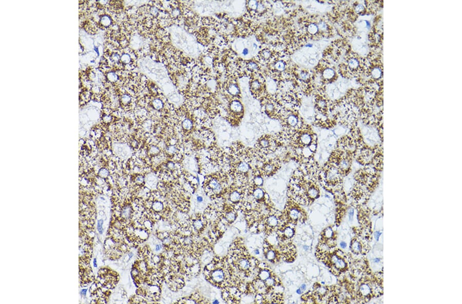 Immunohistochemistry - Anti-ALDH2 Antibody (A13393) - Antibodies.com