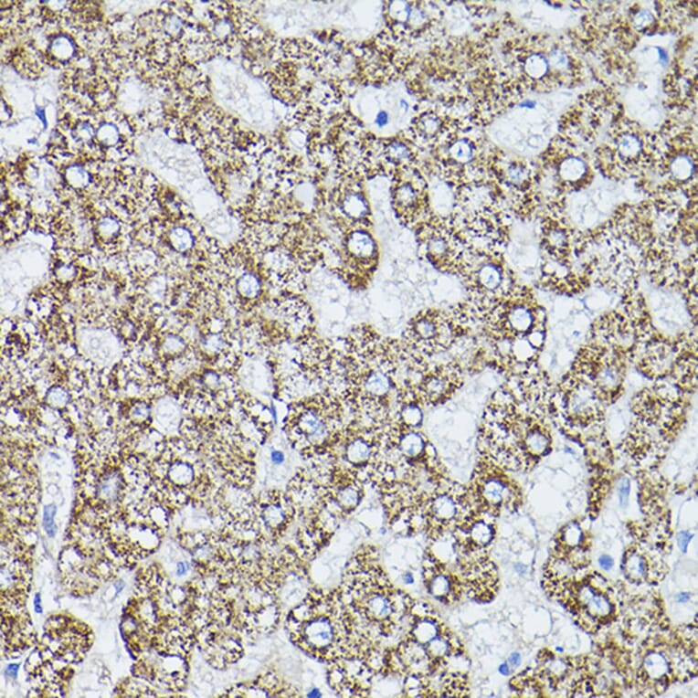 Immunohistochemistry - Anti-ALDH2 Antibody (A13393) - Antibodies.com