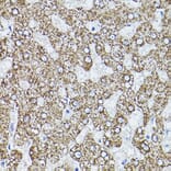 Immunohistochemistry - Anti-ALDH2 Antibody (A13393) - Antibodies.com