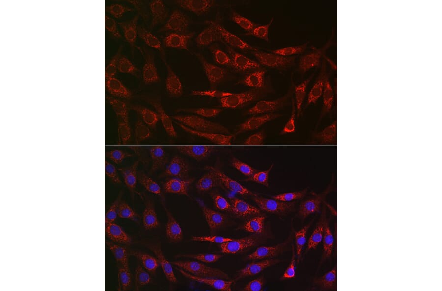 Immunofluorescence - Anti-ALDH2 Antibody (A13393) - Antibodies.com