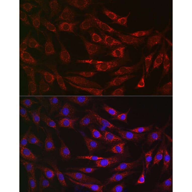 Immunofluorescence - Anti-ALDH2 Antibody (A13393) - Antibodies.com