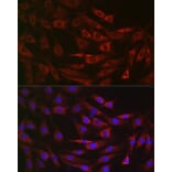 Immunofluorescence - Anti-ALDH2 Antibody (A13393) - Antibodies.com