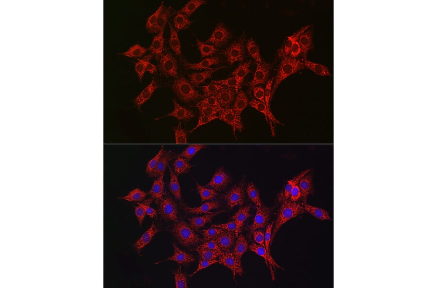Immunofluorescence - Anti-ALDH2 Antibody (A13393) - Antibodies.com