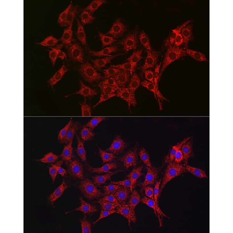 Immunofluorescence - Anti-ALDH2 Antibody (A13393) - Antibodies.com