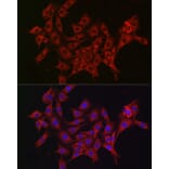 Immunofluorescence - Anti-ALDH2 Antibody (A13393) - Antibodies.com